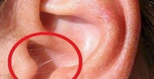 Μεγάλη προσοχή: Δείτε τι σημαίνει αν έχετε τριχοφυΐα στο συγκεκριμένο σημείο του αυτιού