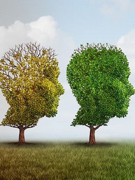 Αλτσχάιμερ: Ελπίδες από νέο φάρμακο που δείχνει να επιβραδύνει τη νόσο