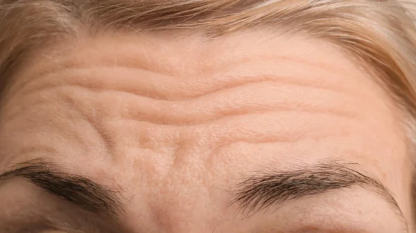 Ανακαλύψτε πώς να προλάβετε και να αντιμετωπίσετε τις λεπτές γραμμές στο μέτωπο