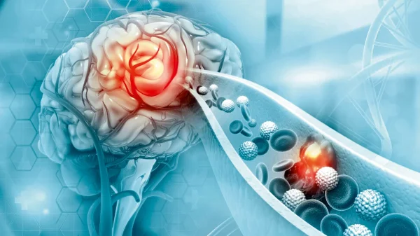 Τρόποι για να μειώσεις τον κίνδυνο εγκεφαλικού επεισοδίου: Προληπτικά μέτρα