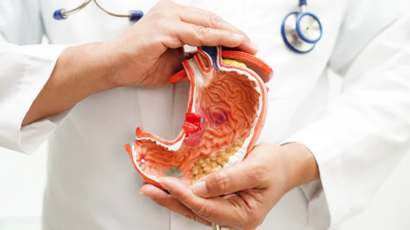 Καρκίνος του στομάχου: Τα 5 προειδοποιητικά σημάδια που δύσκολα αναγνωρίζουμε