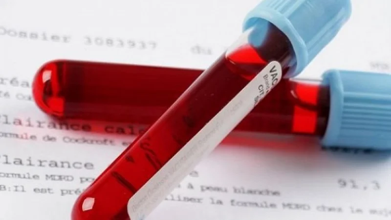 Ποια ομάδα αίματος αυξάνει τον κίνδυνο για πρόωρο εγκεφαλικό