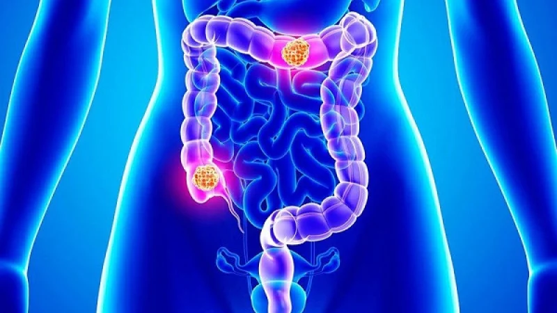 Διαγνώστηκε με καρκίνο στα 33 της μοιράζεται τα 2 συμπτώματα που αγνόησε