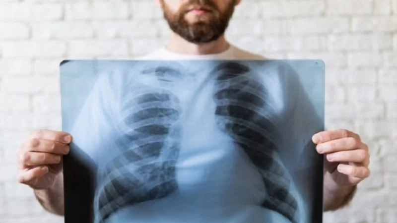 Καρκίνος του πνεύμονα: Τι ρόλο παίζει ο ταχυδρομικός κώδικας – Τα ευρήματα ελληνικής μελέτης